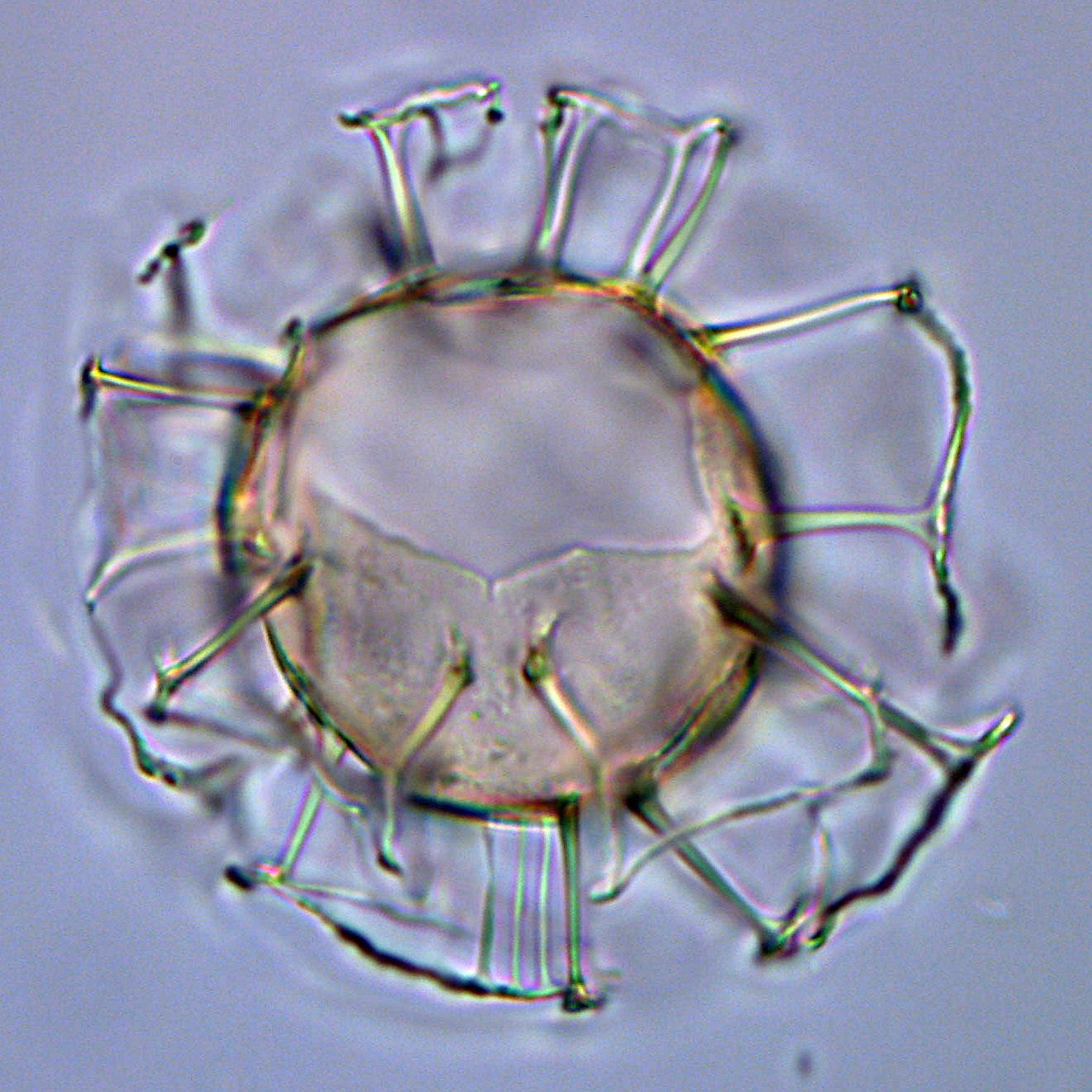 Emmetrocysta sp., 1410C-9H-4, 15-17, F28, foto-b.jpg